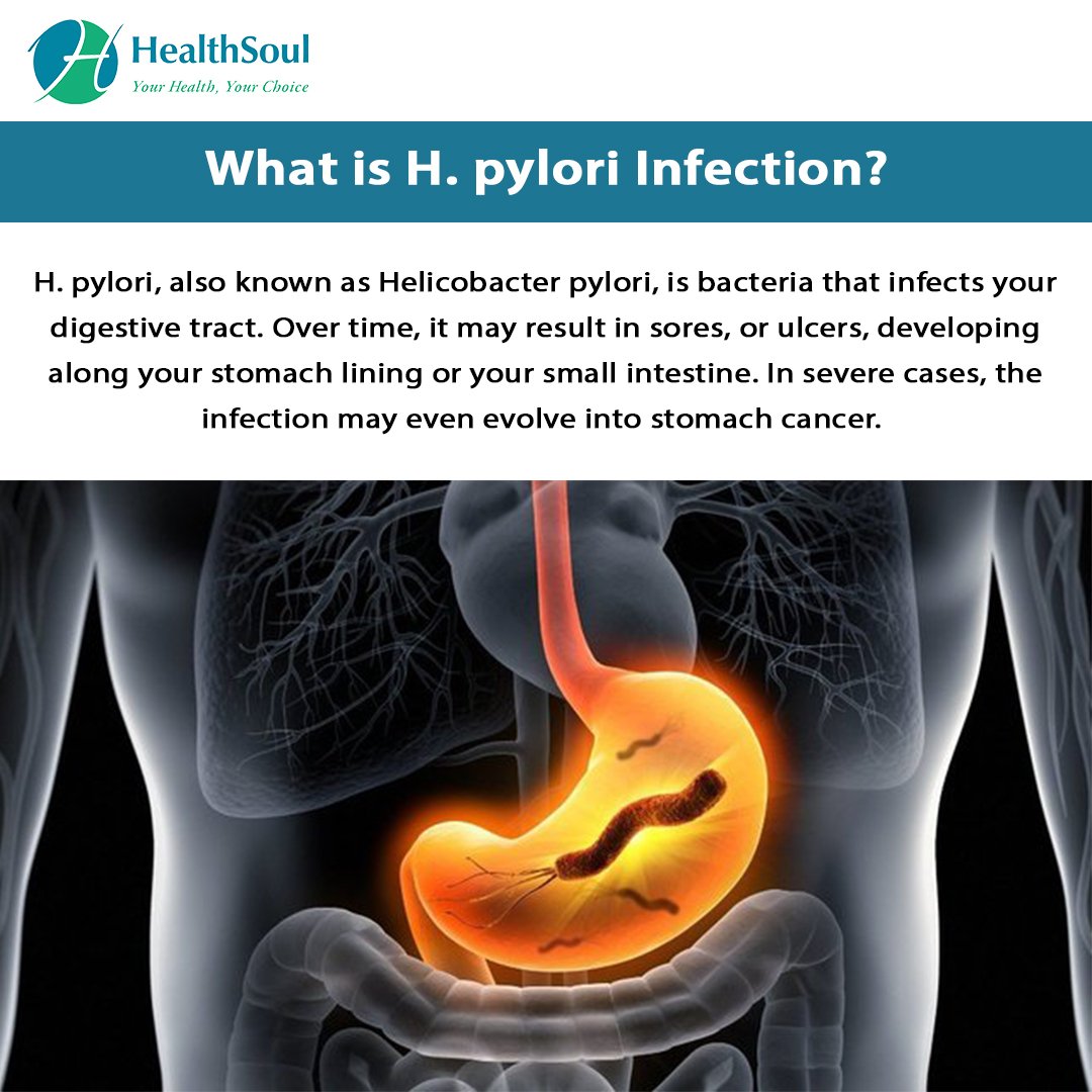 H. pylori Infection: Symptoms and Treatment ...