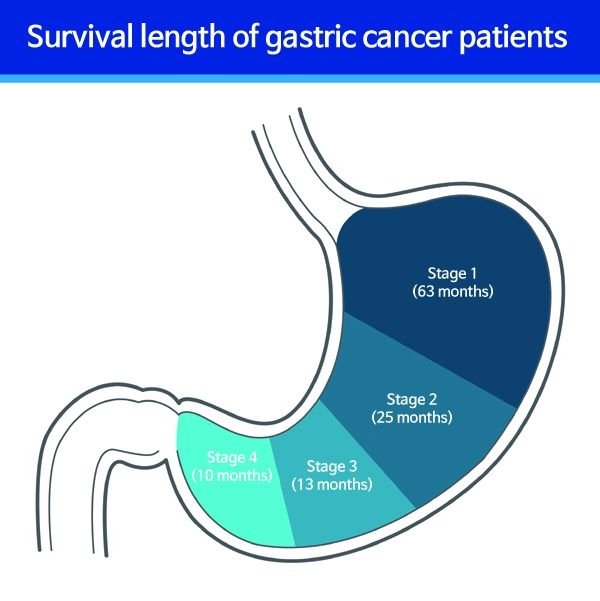 Refusing Treatment For Stomach Cancer Stage 3