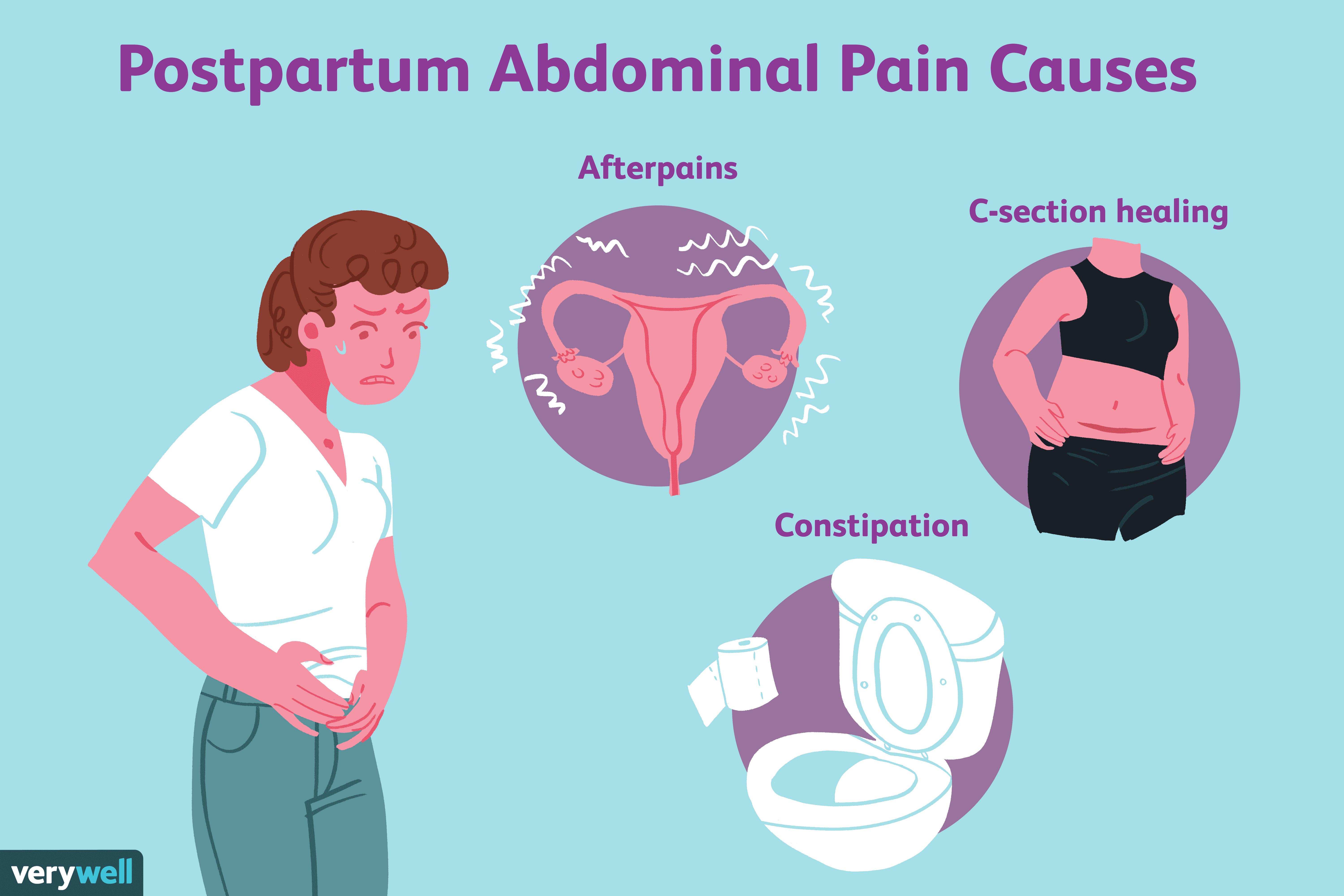 Causes of Postpartum Abdominal Pain