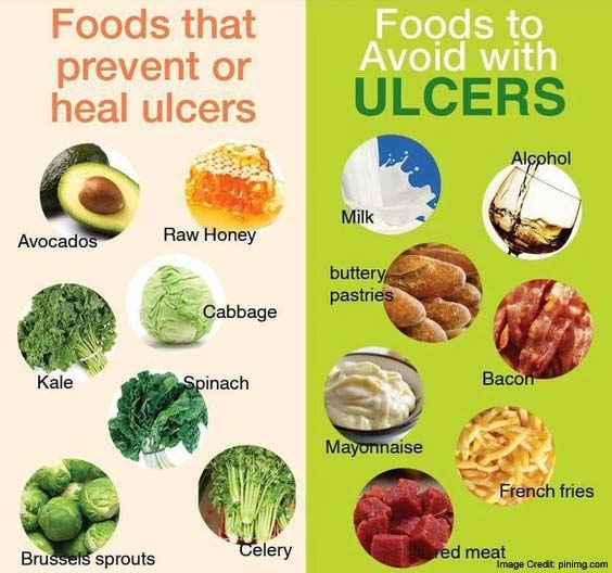How Can You Treat the Stomach Ulcers with Home Remedies?