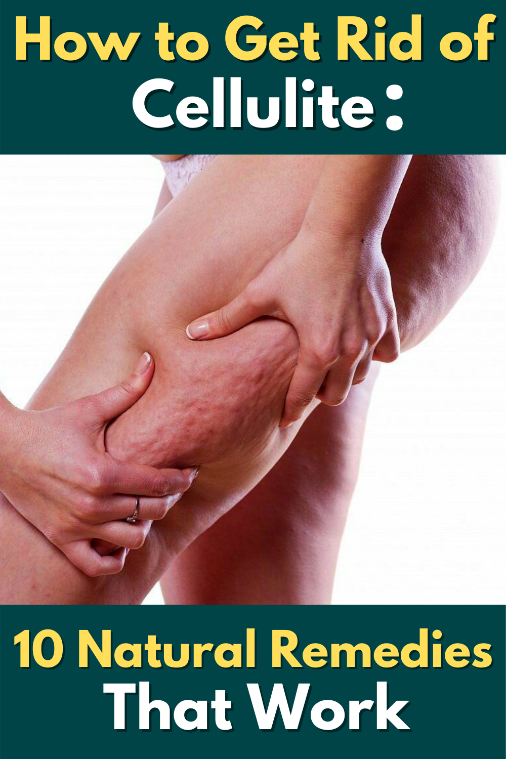 How to Get Rid of Cellulite: 10 Natural Remedies That Work ...