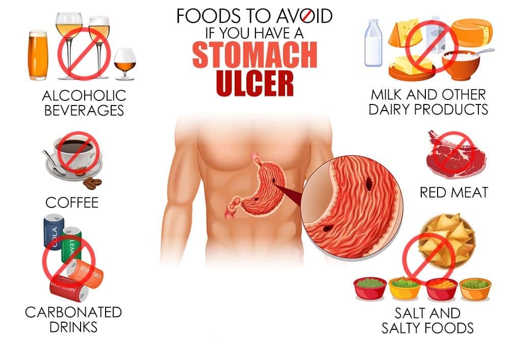 Natural treatment for stomach ulcers