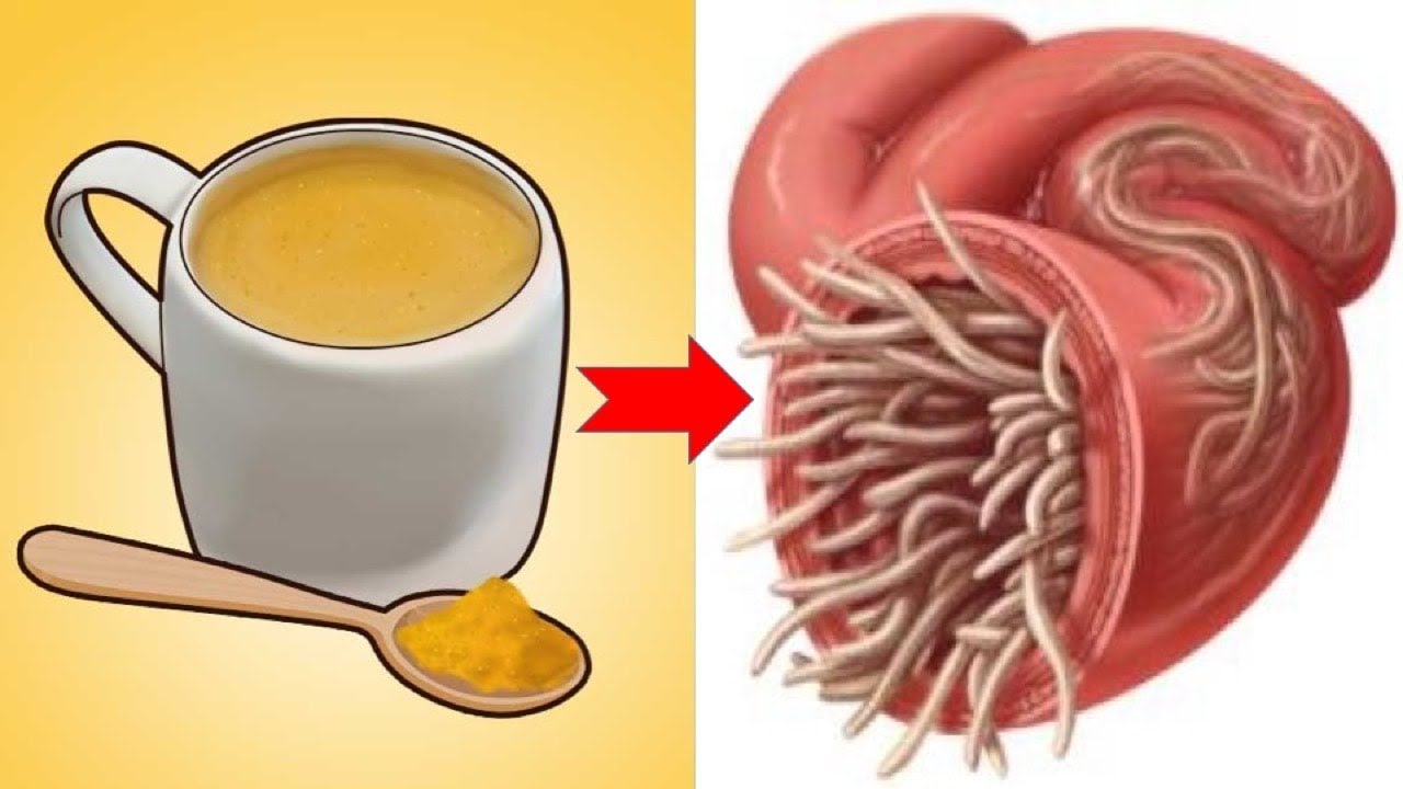 Natural Ways To Get Rid Of Intestinal Worms In No Time ...