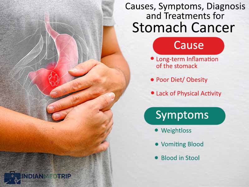 What Symptoms Do You Have If You Have Stomach Cancer : Ask ...