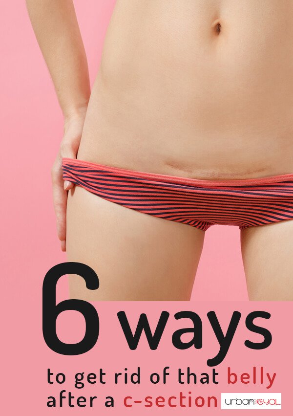 6 Ways To Get Rid Of That Belly After A C