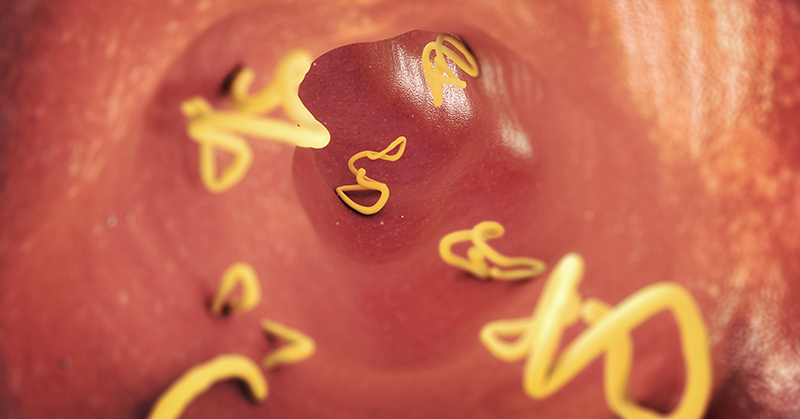 How To Tell If You Have Worms In Your Stomach