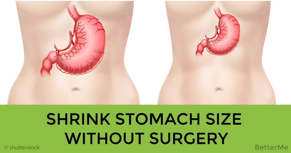 Shrink stomach size without surgery by following these tips