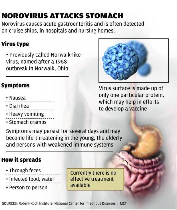 Stomach virus spreads around St. Louis : Lifestyles