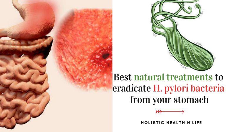 Best natural treatments to eradicate H. pylori bacteria ...