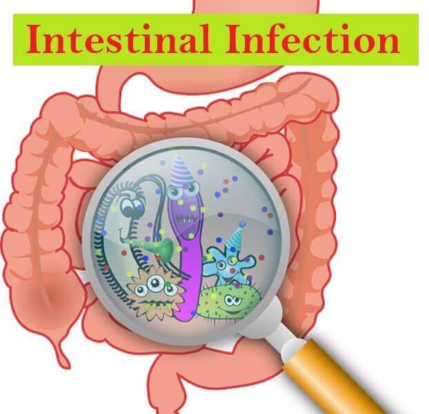 Intestinal Infection: Types, 3 Causes, Symptoms, And ...