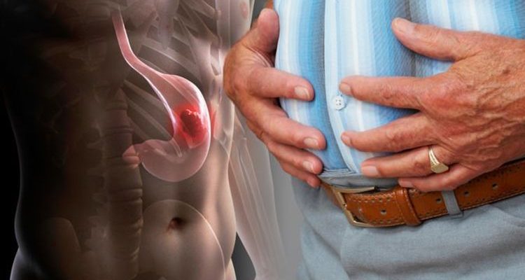 Stomach cancer symptoms: Nine signs you could have the ...