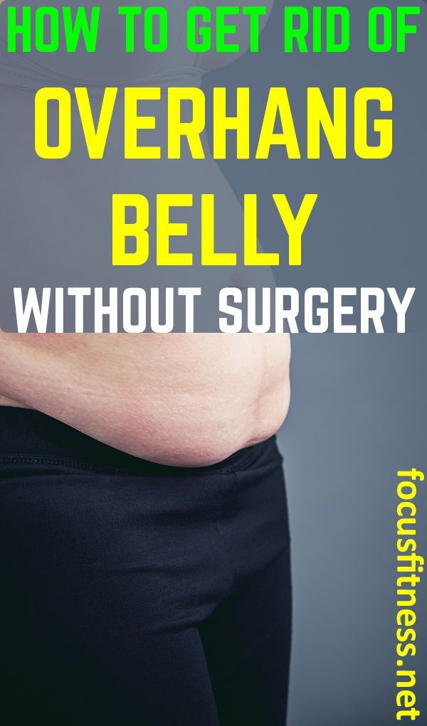 10 Tips On How To Get Rid Of Stomach Overhang Without Surgery