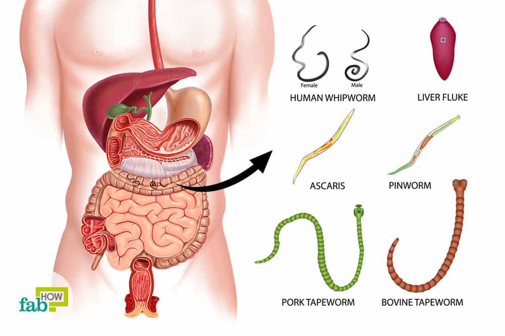 How to Get Rid of Worms in Humans: 6 Simple Home Remedies ...