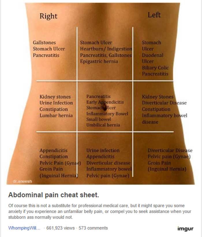 The 25+ best Abdominal pain ideas on Pinterest