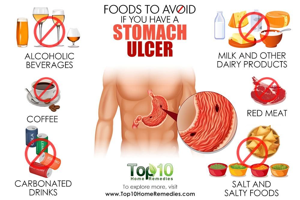 Pin on Ulcer