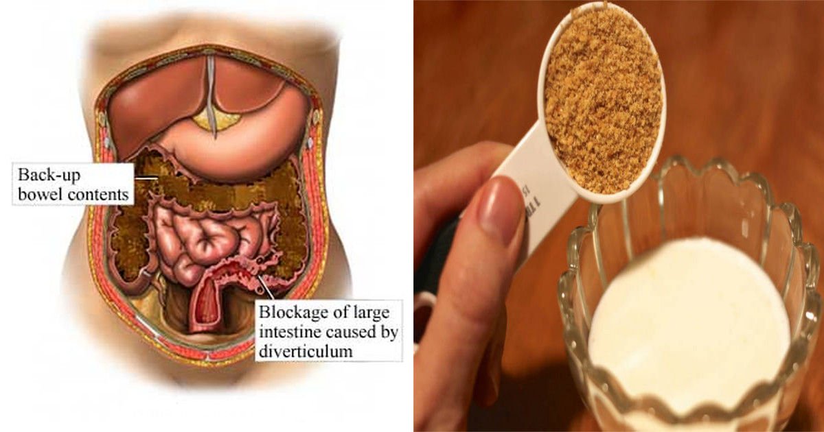 Effective Colon Cleansing Remedy Using 2 Ingredients
