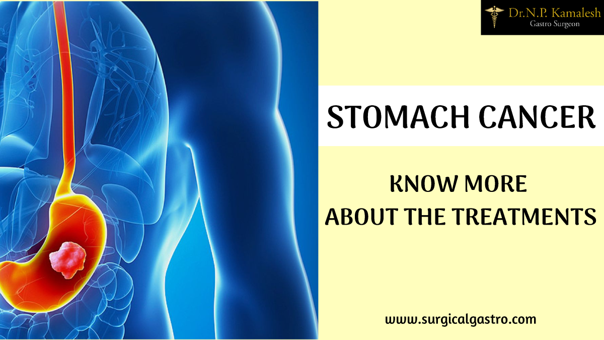 Stomach Cancer Treatment in Kochi