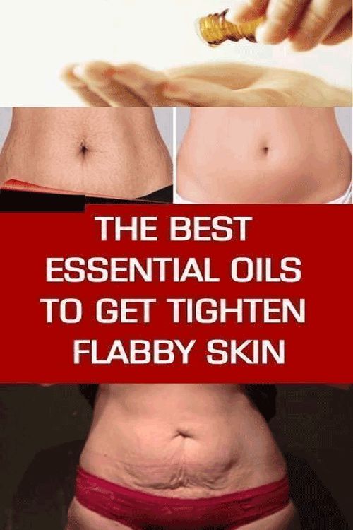 Here are 6 best essential oils to tighten flabby skin fast!