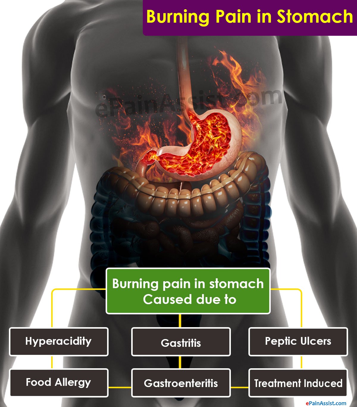 What Can Cause Burning Pain in Stomach?