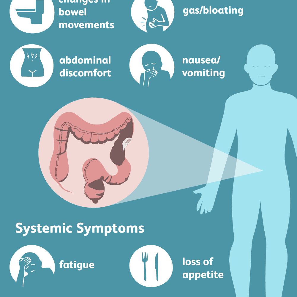 Are The Signs Of Stomach Cancer