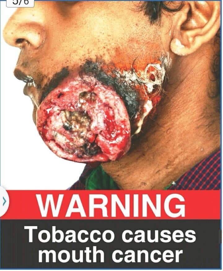 BEBAS ROKOK BANDUNG on Twitter: " warning, smoking causes mouth cancer ...
