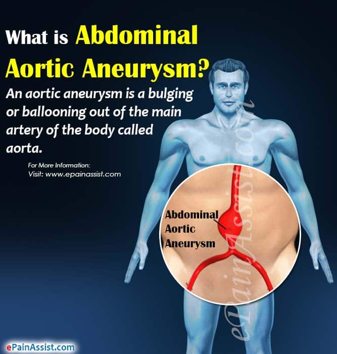 What is Abdominal Aortic Aneurysm &  How is it Repaired?