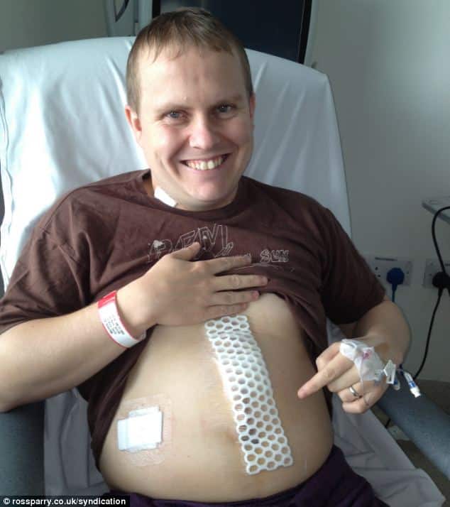 Father with rare cancer gene has stomach removed to avoid the disease ...