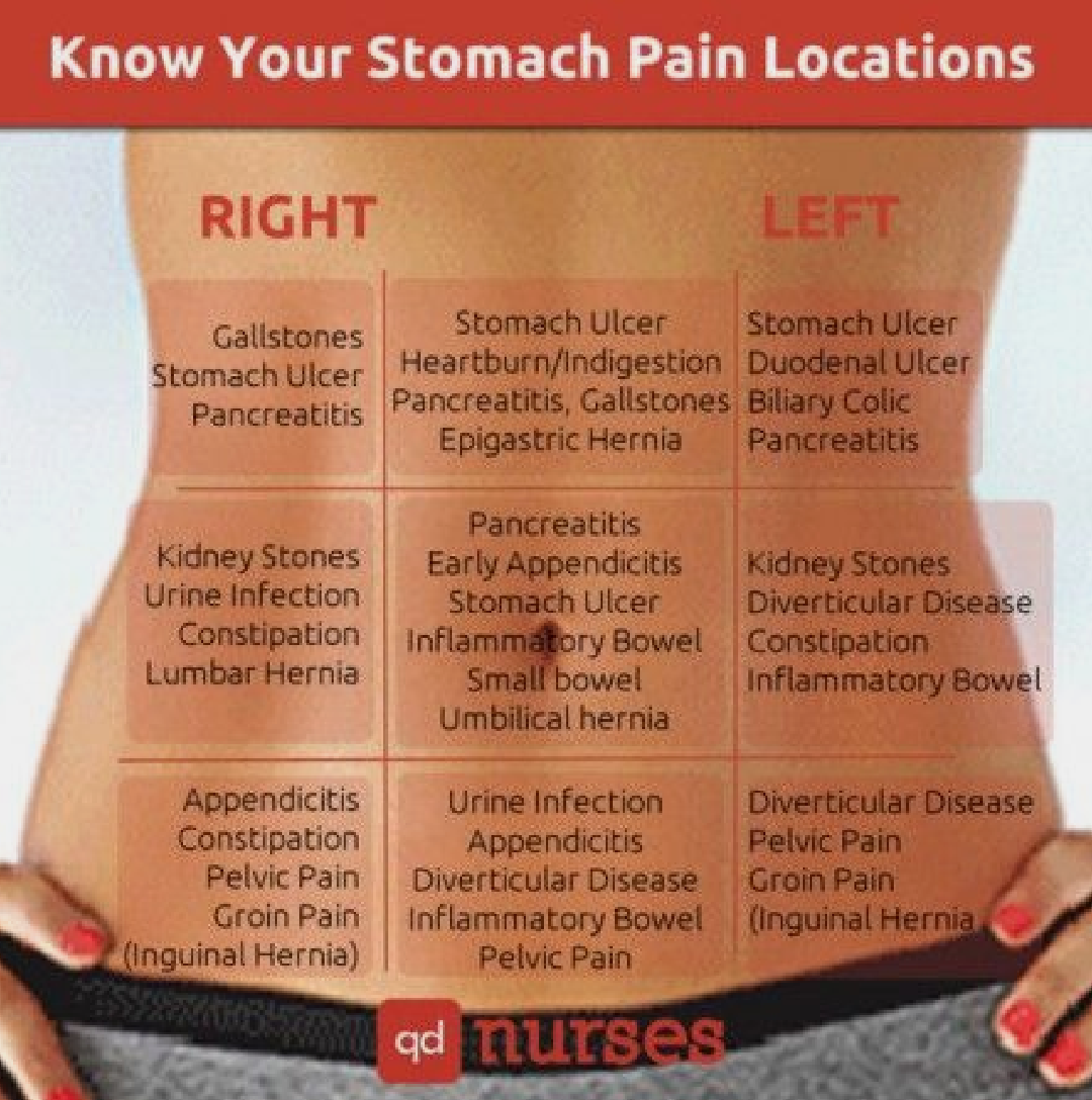 Know your stomach pain locations. : r/coolguides