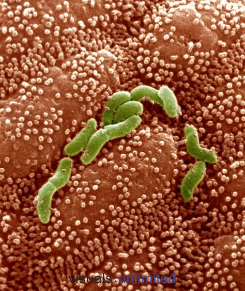 These Helicobacter pylori bacteria (formerly Campylobacter) on human ...