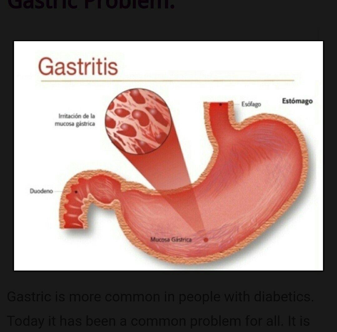 Solution for gastric trouble