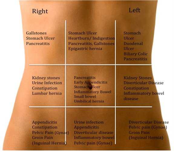 Stomach Ache Map  This Is What Your Stomach Ache Reveals About Your ...