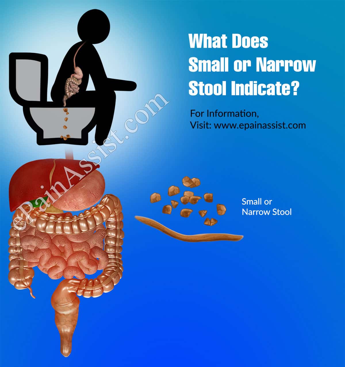 What Does Small or Narrow Stool Indicate?